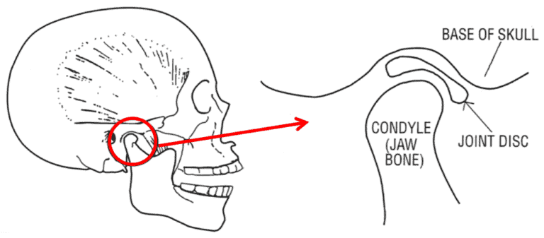 What Is TMJ? - Portalupi Orthodontics